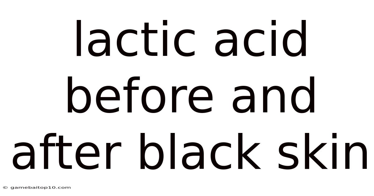 Lactic Acid Before And After Black Skin