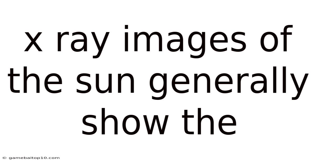 X Ray Images Of The Sun Generally Show The